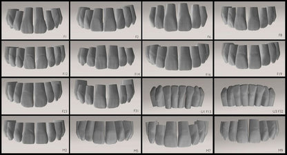 ANTERIORES 3D TOOTH LIBRARY PACKAGE