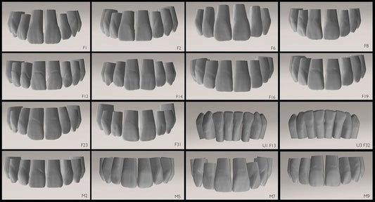 ANTERIORES 3D TOOTH LIBRARY PACKAGE