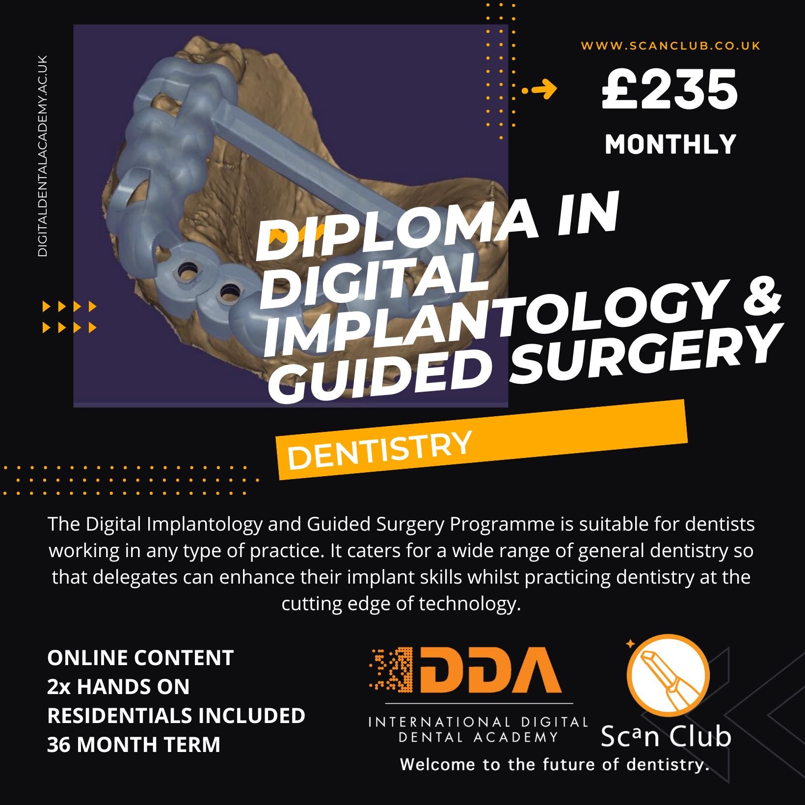 Scan Club Scan Club Diploma in Digital Implantology Membership